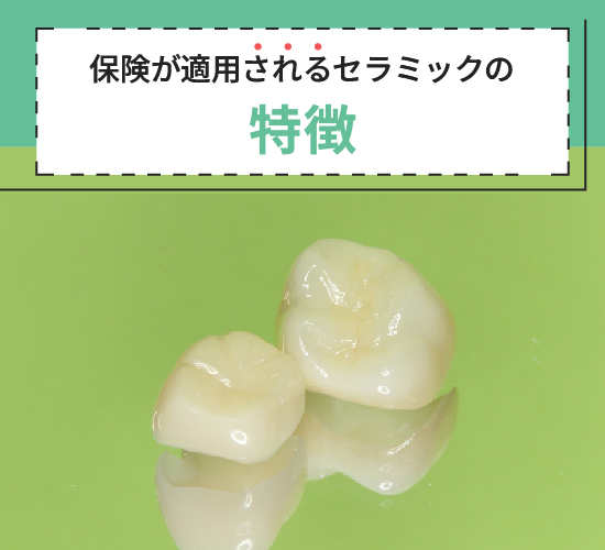 保険が適用されるセラミックの特徴