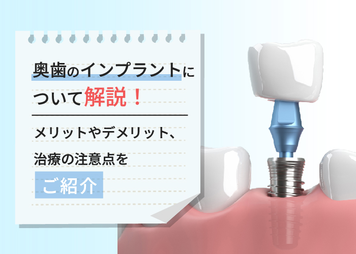 奥歯のインプラントについて解説！デメリットやメリット、治療の注意点をご紹介