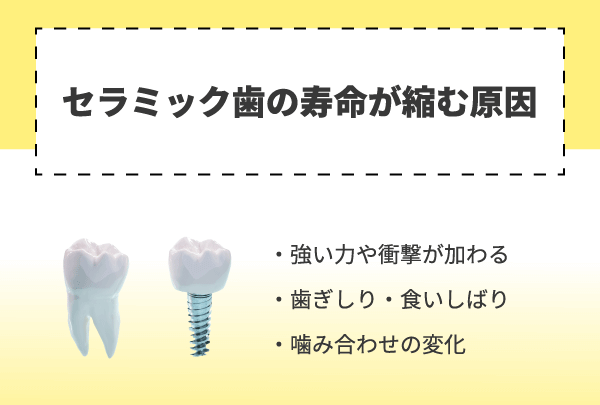 セラミック歯の寿命が縮む原因