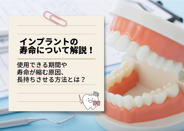 インプラントの寿命について解説！使用できる期間や寿命が縮む原因、長持ちさせる方法とは？