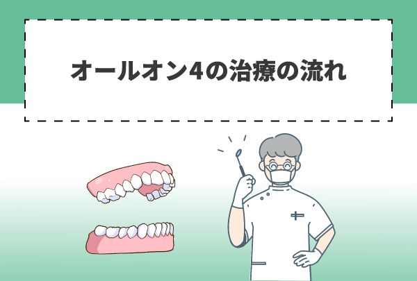 オールオン4の治療の流れ