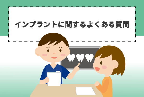 インプラントに関するよくある質問