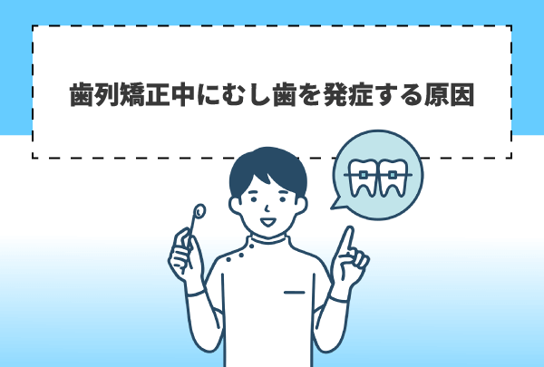 歯列矯正中にむし歯を発症する原因